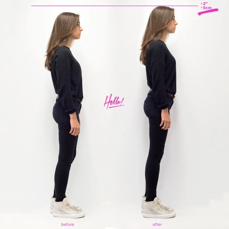 Invisible Heels Before & After Picture